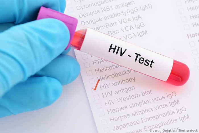 ѧоHIV